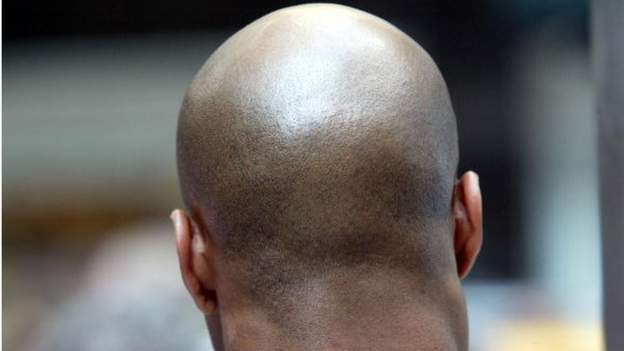 Bald man decapitated in ritual attack