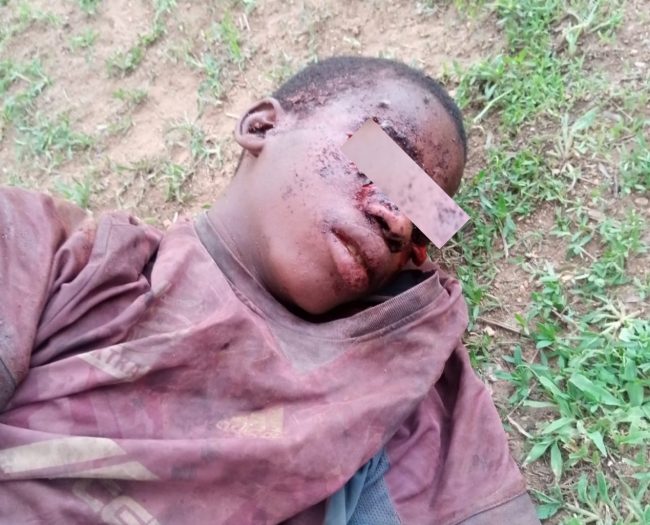Bauchi police hunt for culprits after teenager's eyes removed